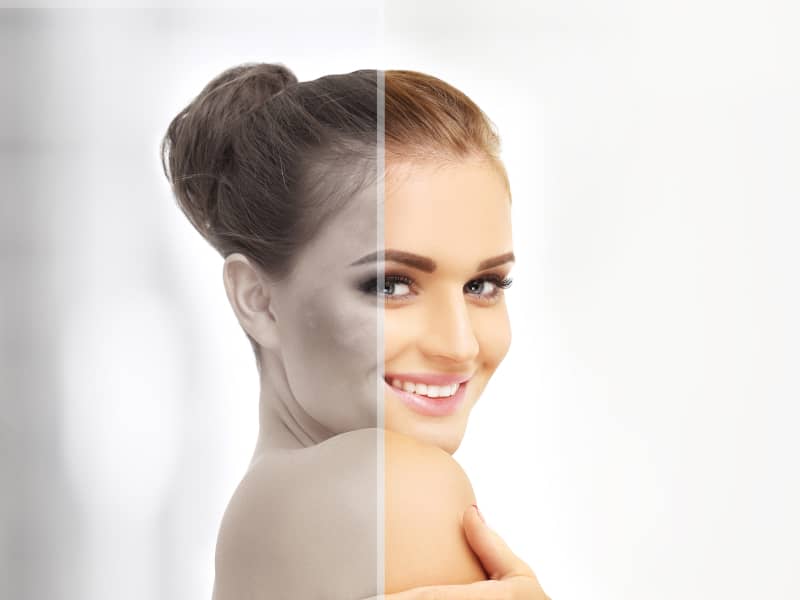 تجميل الوجه