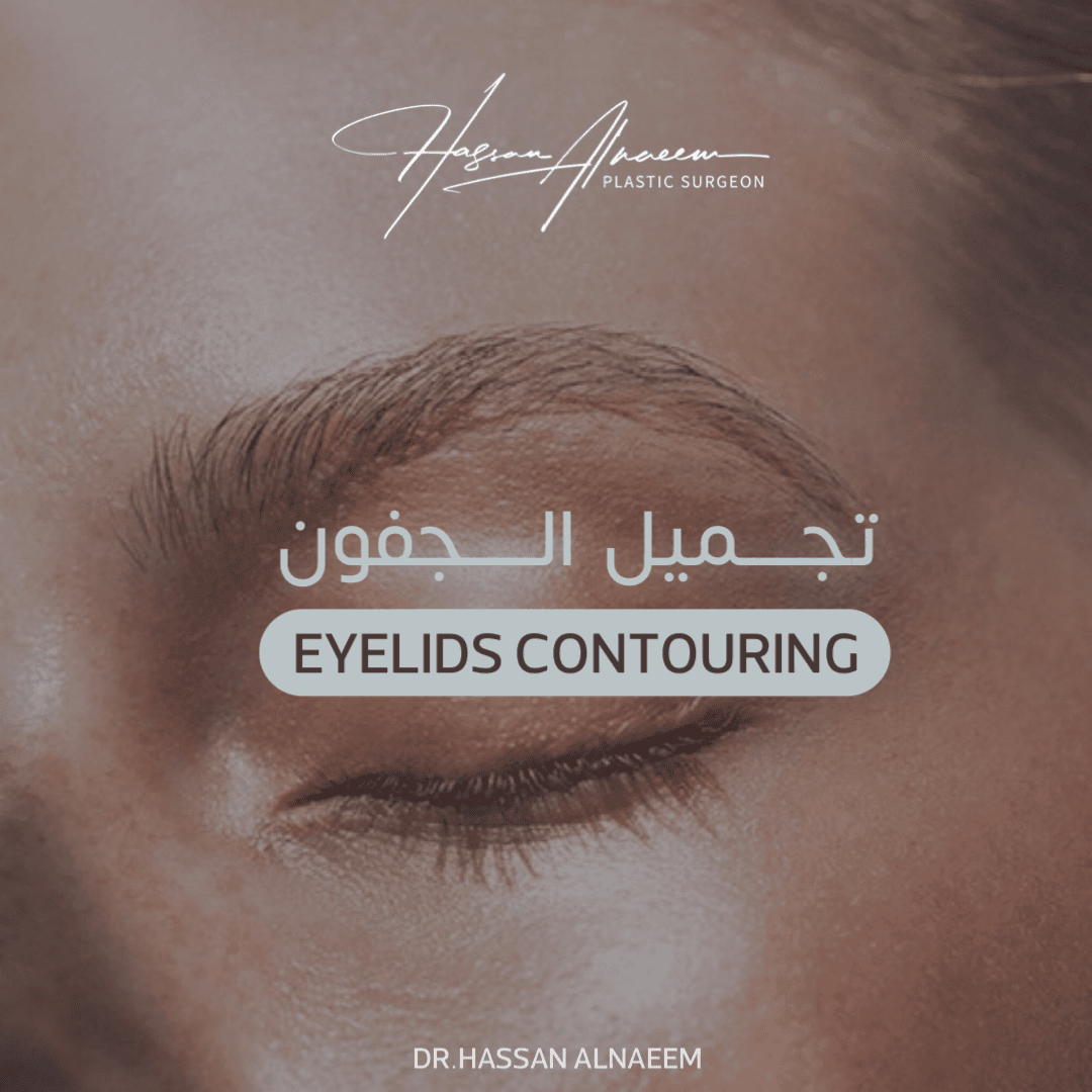 تجميل الجفون