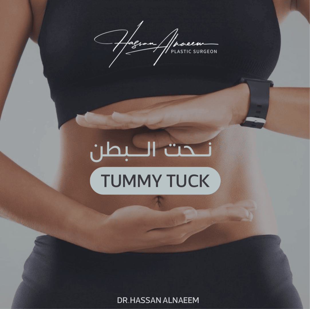 شفط دهون ونحت البطن