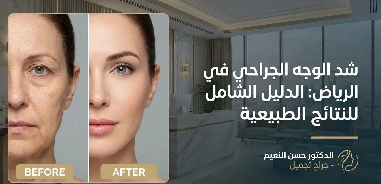نتائج شد الوجه الجراحي في الرياض قبل وبعد – د حسن النعيم