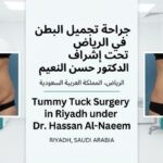 نتائج شد البطن قبل وبعد في الرياض تحت إشراف د  حسن النعيم