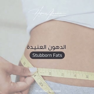 علاج الدهون العنيدة في الرياض الدكتور حسن النعيم استشاري جراحة التجميل