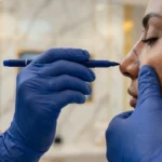 عمليات تجميل الانف في عيادة د  حسن النعيم بالرياض