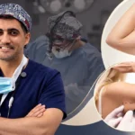 د  حسن النعيم استشاري جراحة التجميل في الرياض مع تخطيط الذراع قبل الإجراء – هل شفط دهون الذراعين يشد الجلد