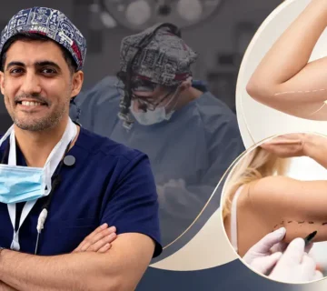 د  حسن النعيم استشاري جراحة التجميل في الرياض مع تخطيط الذراع قبل الإجراء – هل شفط دهون الذراعين يشد الجلد