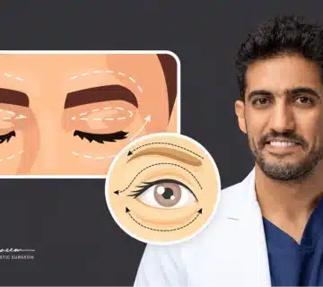 د  حسن النعيم الفرق بين قص الجفون ورفع الحاجب